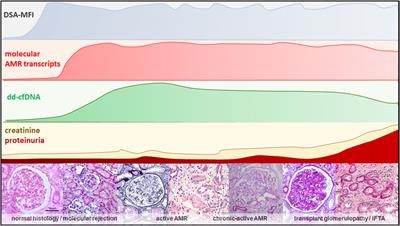 Perspective for Donor-Derived Cell-Free DNA in Antibody-Mediated Rejection After Kidney Transplantation: Defining Context of Use and Clinical Implications